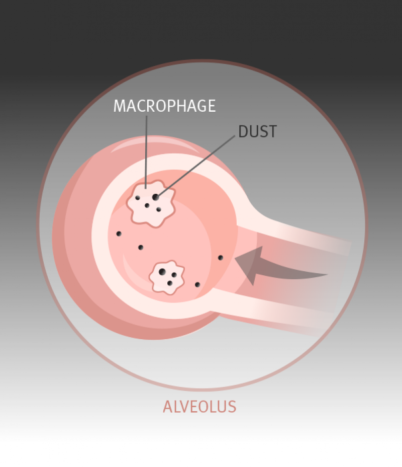 They send out chemicals to attract more macrophages and other similar types of cells. They work together to engulf and clear the dust particles.