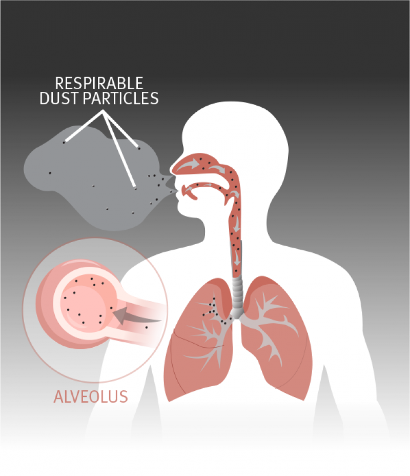 Because respirable dust particles are so small, they’re able to travel all the way into the alveoli, where they can cause irritation inside the air sac.
